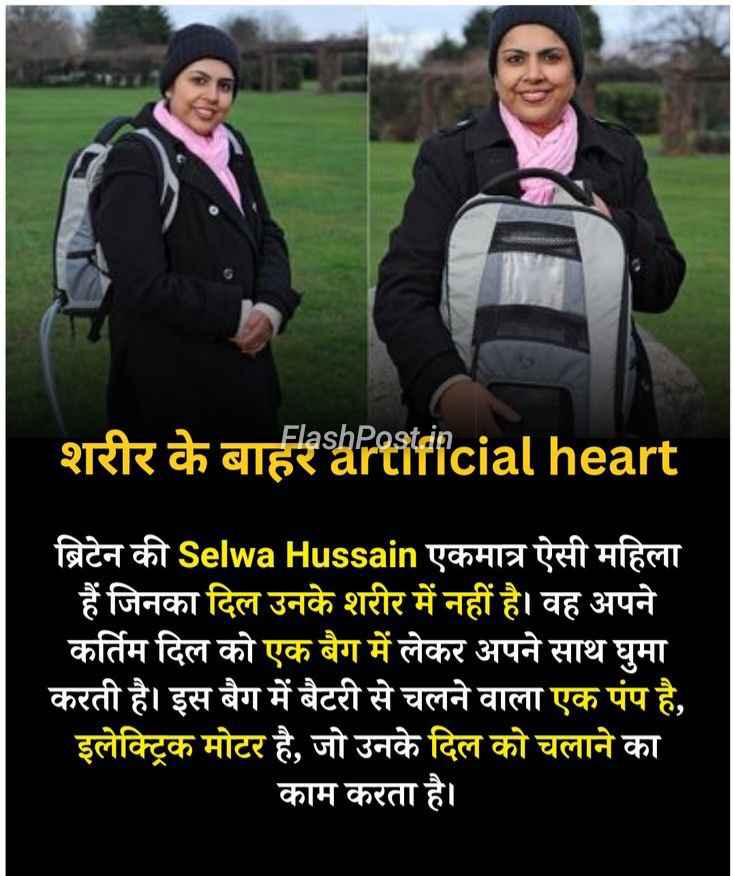 Aisa Bhi Hota Hai? Milao Selwa Hussain Se, Jinka Dil Shareer Ke Bahar Dhadakta Hai!